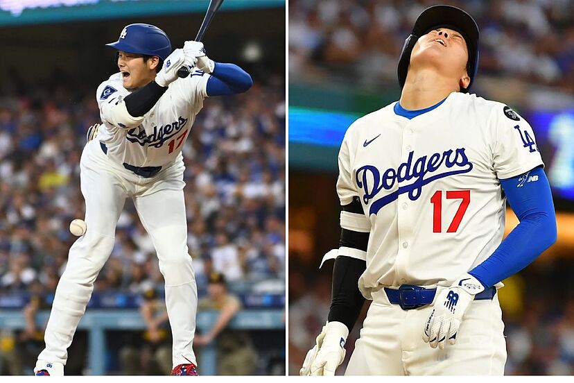 Shohei Ohtani comparte impresionante foto en redes tras ser golpeado por  lanzamiento | Marcausa