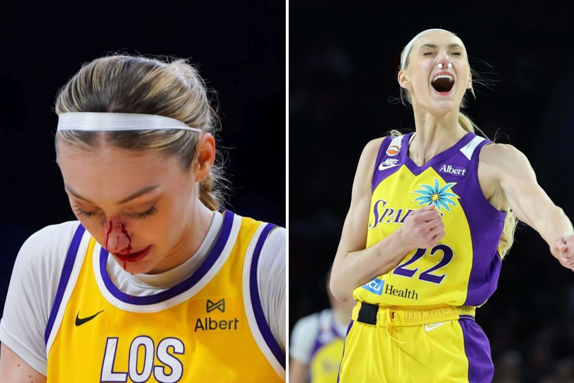 Cameron Brink sangra por segunda vez durante un juego de la WNBA